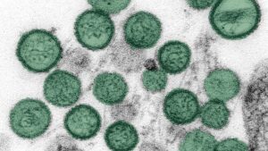 Hantavirus को लेकर बढ़ी चर्चा, जानिए कितना खतरनाक है यह वायरस