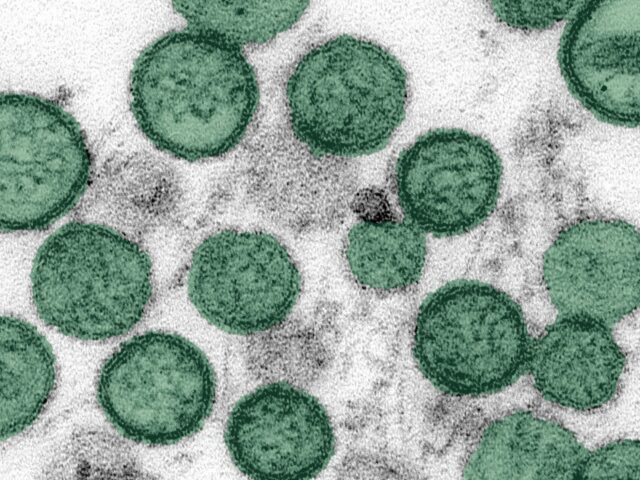 Hantavirus को लेकर बढ़ी चर्चा, जानिए कितना खतरनाक है यह वायरस
